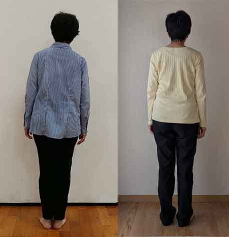 関節整体ビフォーアフター