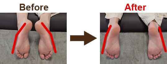 関節整体ビフォーアフター