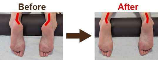 関節整体ビフォーアフター