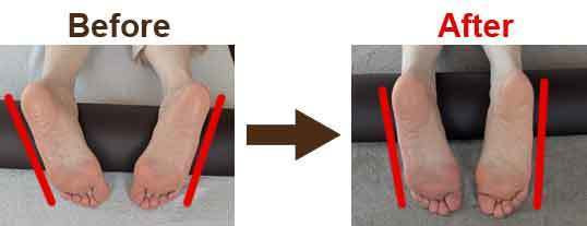 関節整体ビフォーアフター