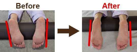 関節整体ビフォーアフター