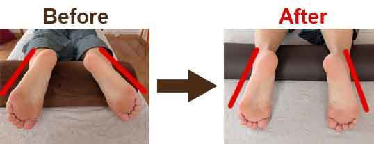 関節整体ビフォーアフター