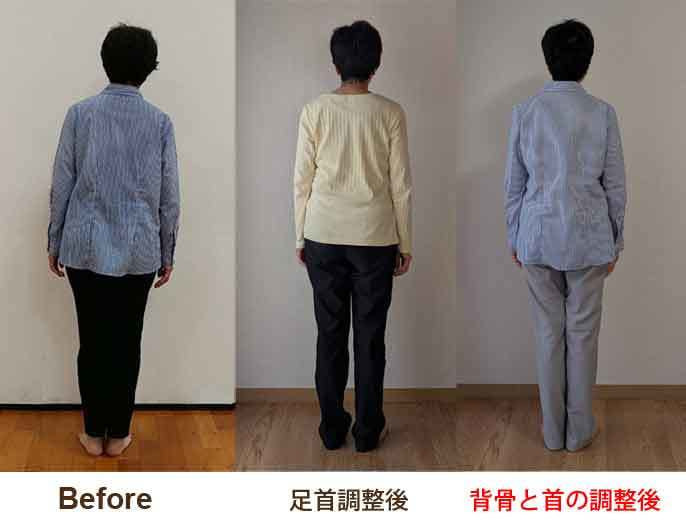 背骨の関節整体